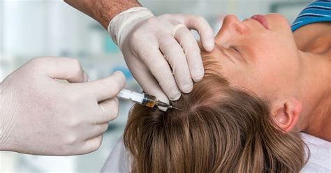 Haartransplantatie En Haaruitval: Wat Is De Verbinding?