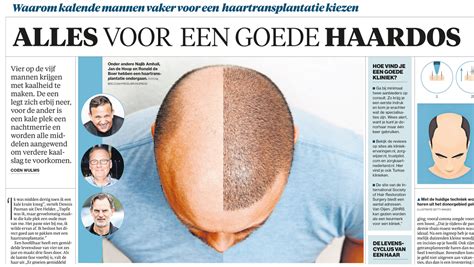 Waarom Haartransplantatie De Uitkomst Is Voor Veel Mensen